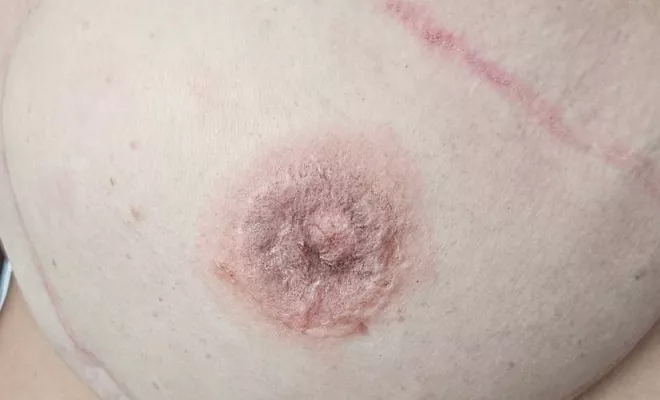 Aréole mammaire, Cannes, Alabama Knox Tatoo