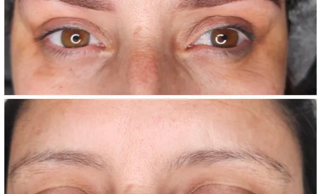 Création complète pour ma cliente, avant après